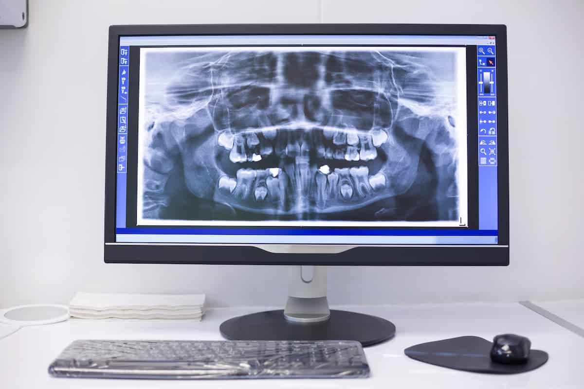 An X-ray on a monitor